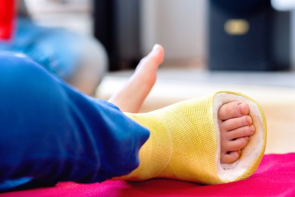 illustrasjonsbilde av et barnebein med gul gips